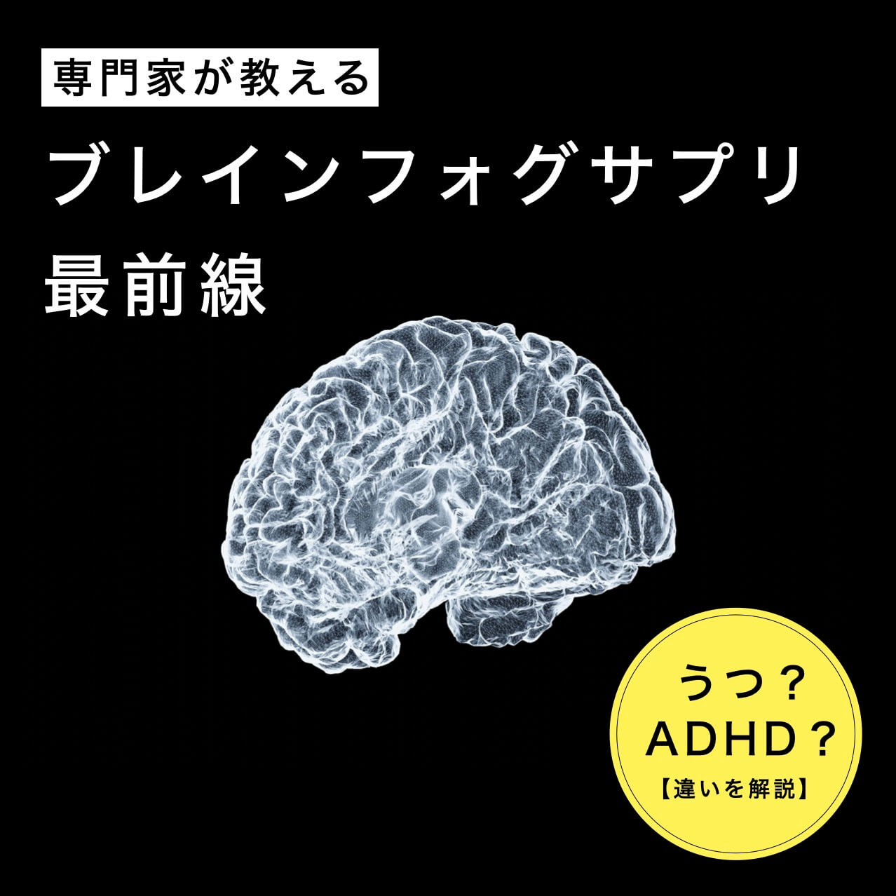 ブレインフォグのイメージ写真