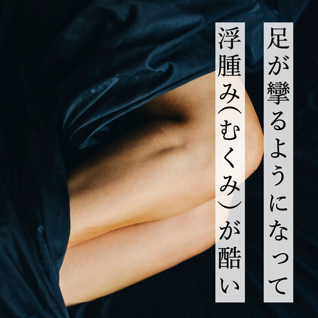 足の攣りとむくみがひどい更年期女性