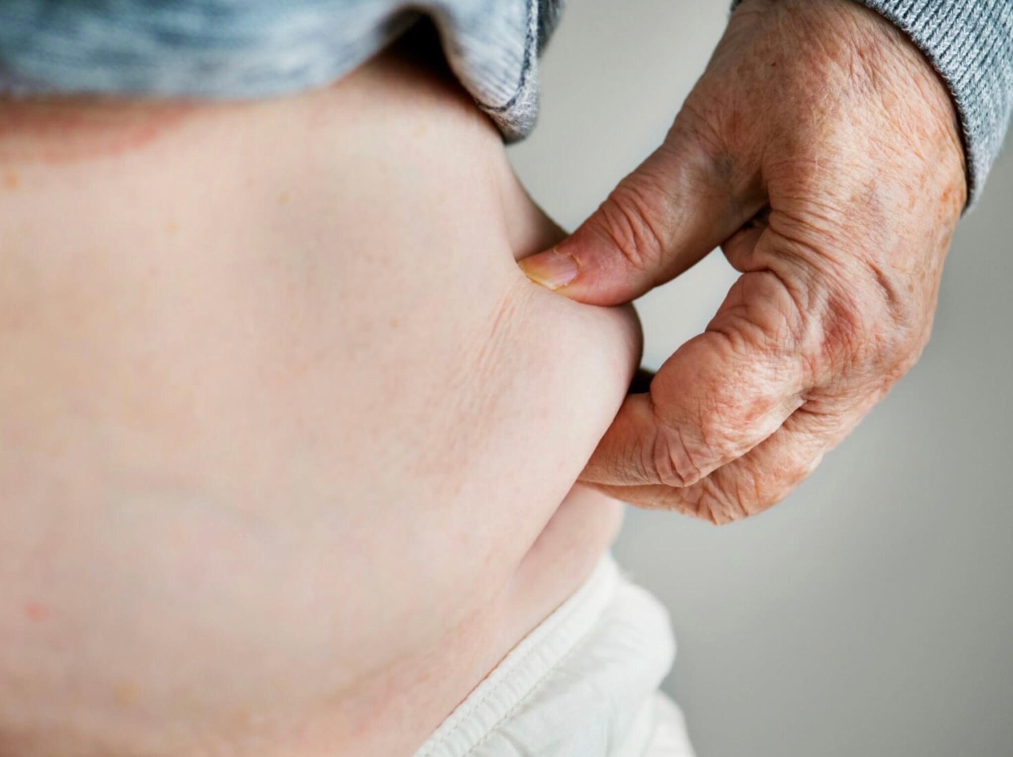 コレステロール値を気にしている女性のお腹の写真