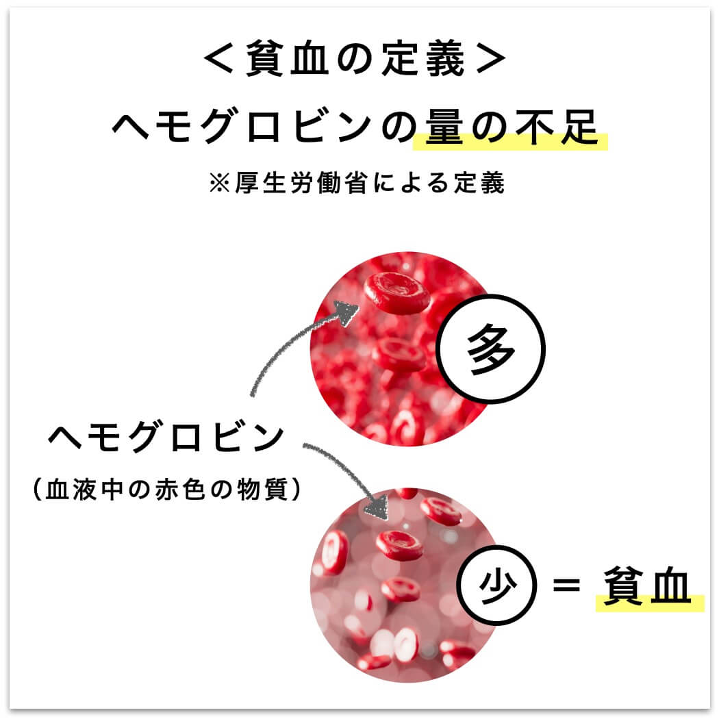 貧血の定義はヘモグロビン不足