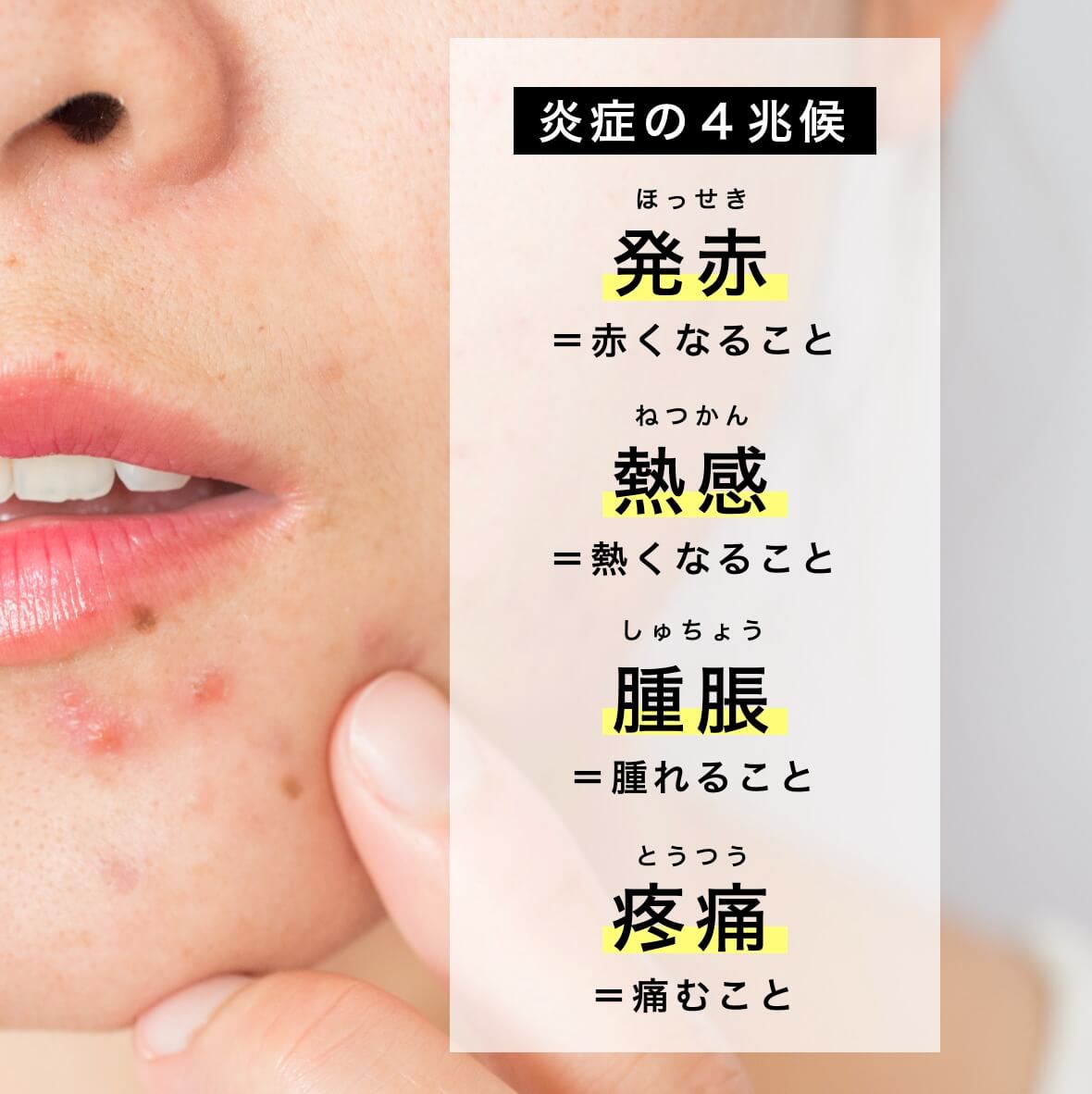 炎症の４兆候