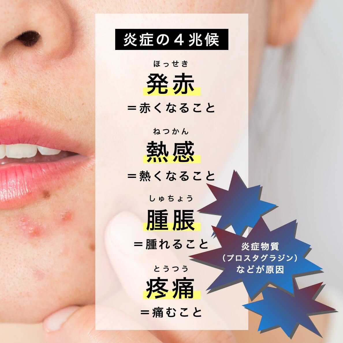 炎症の４兆候