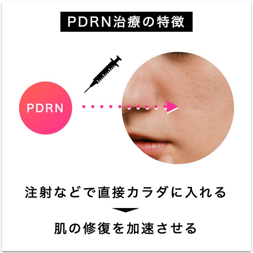 美容医療で行われるPDRN治療の特徴