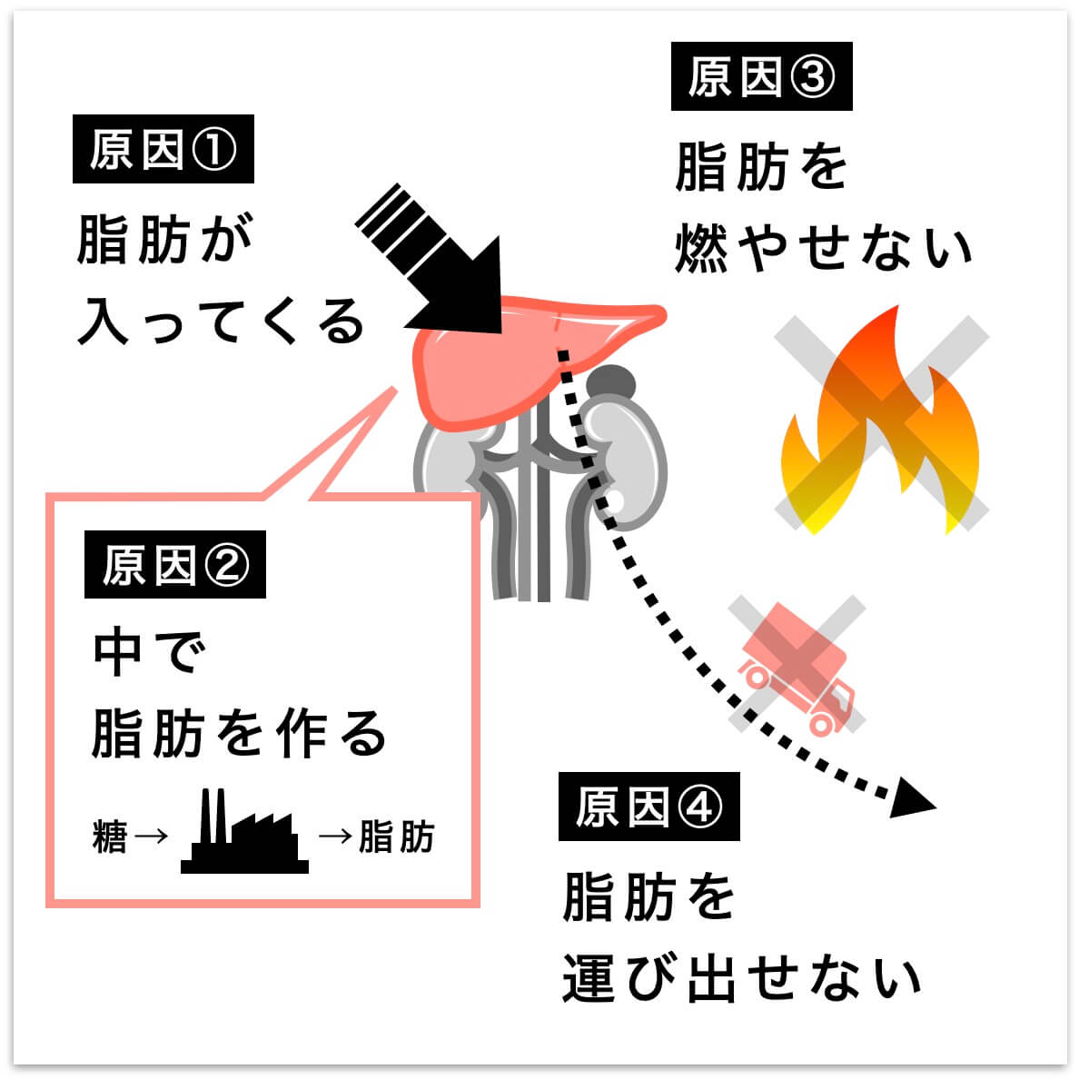 脂肪肝の原因４つ