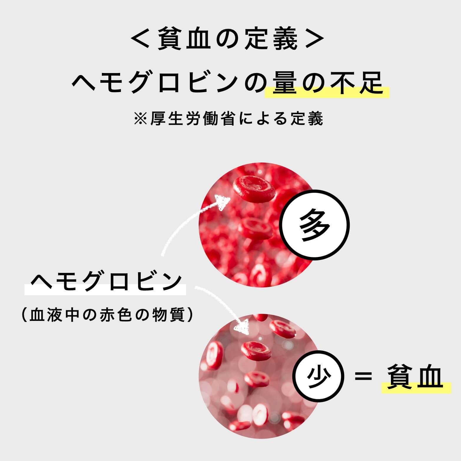 貧血の定義の説明図