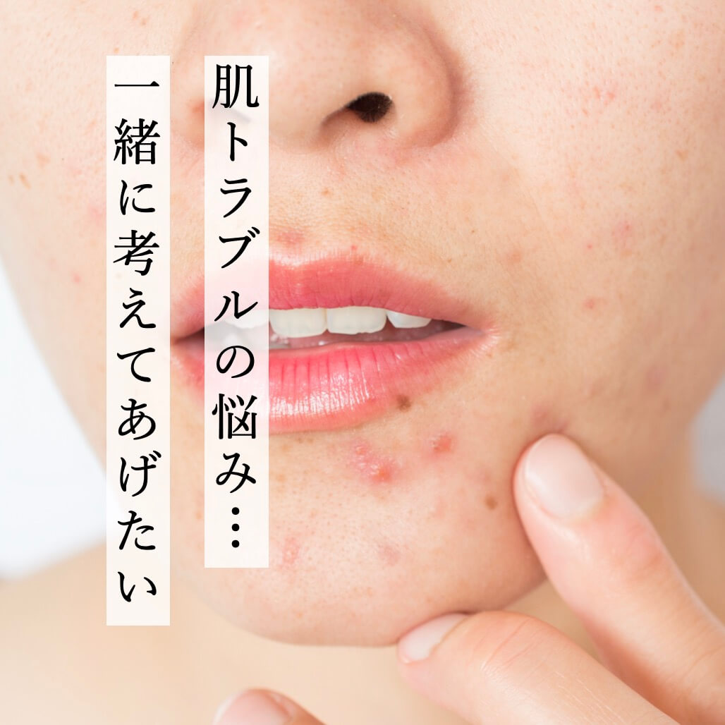 肌トラブル、炎症に悩む思春期女性