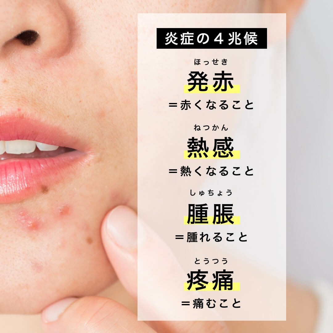 炎症の4兆候