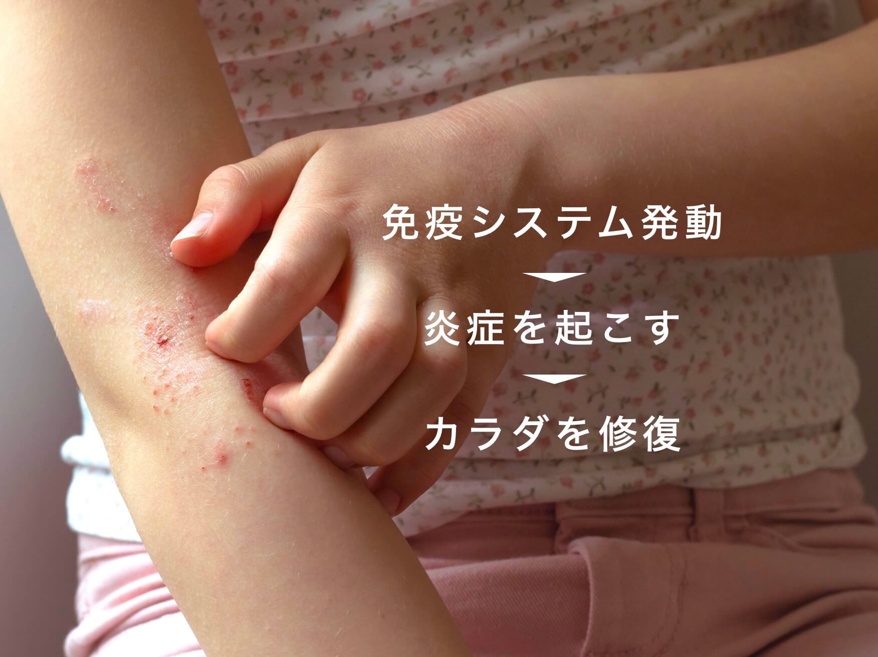 防衛システムと脳炎症の関係を説明した図