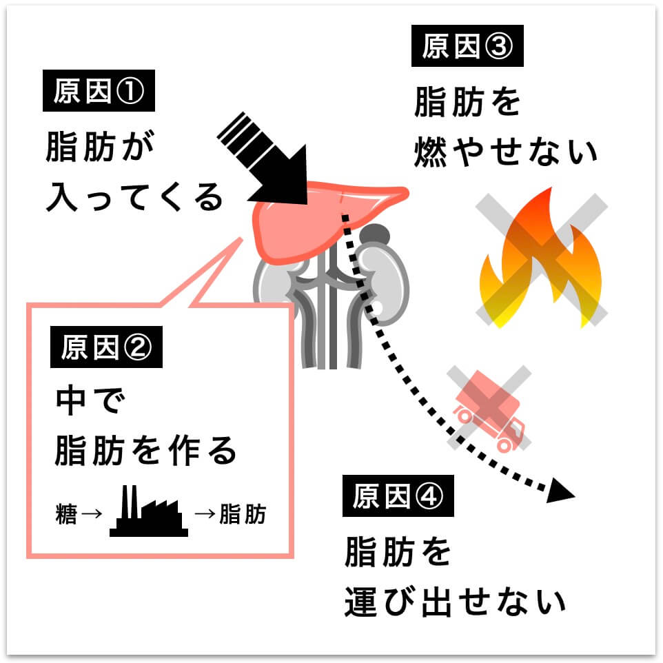 脂肪肝についての説明