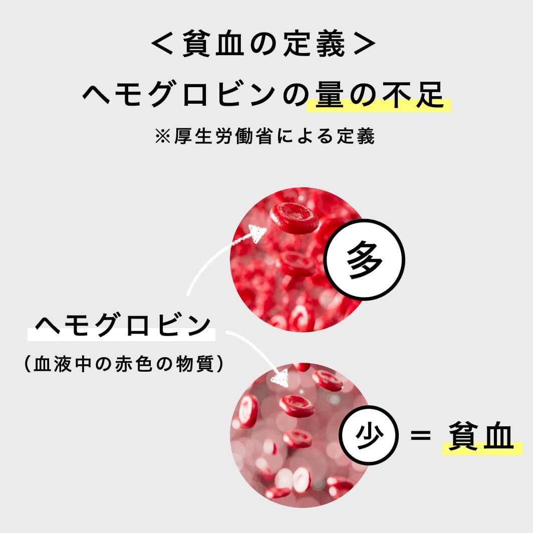 貧血の定義を解説