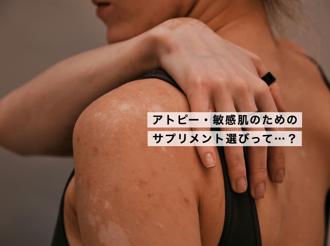 アトピー肌に悩む女性の背中