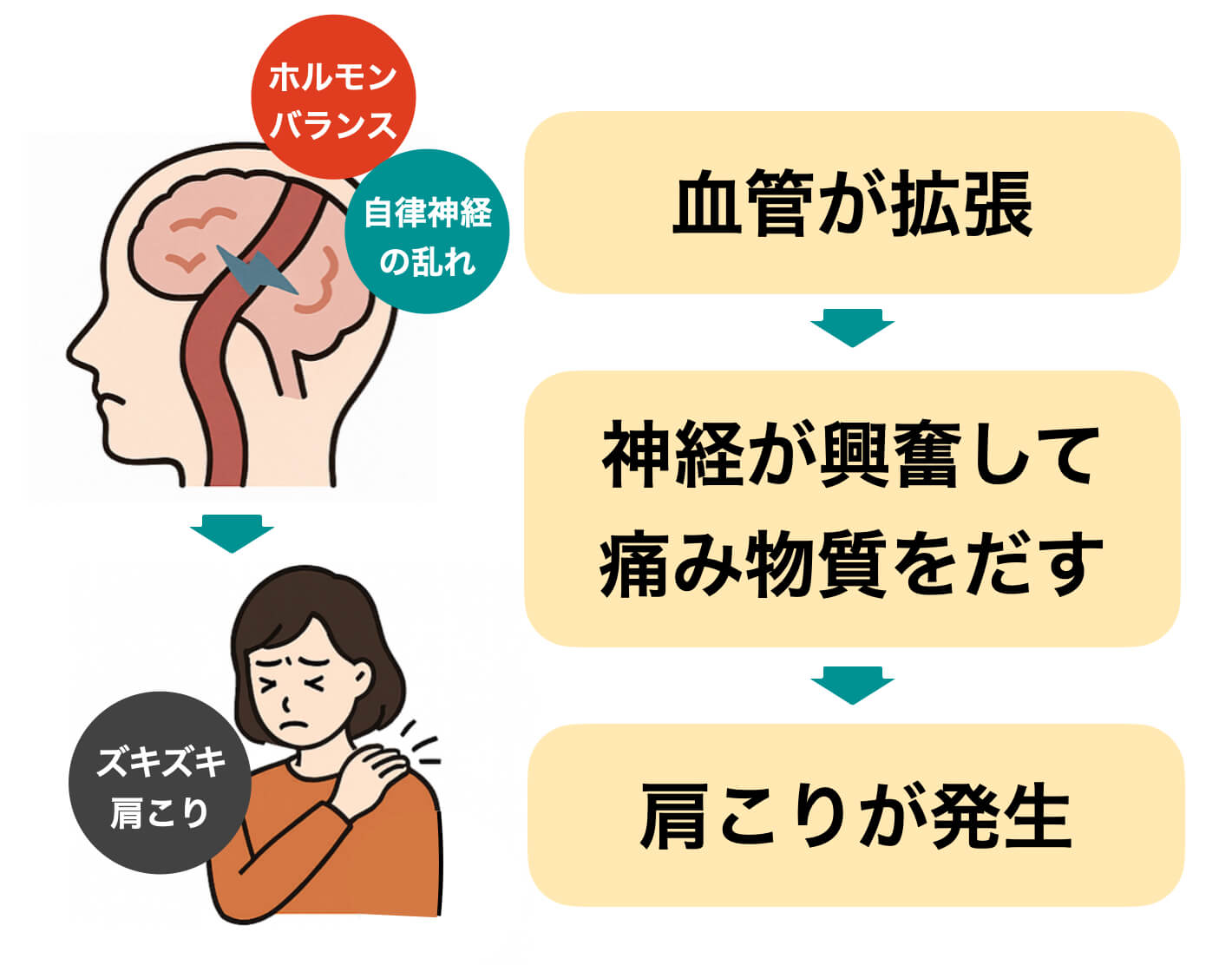 “片頭痛”と肩こりが同時に起こるメカニズムを図解